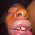 BIG LIP AHHH